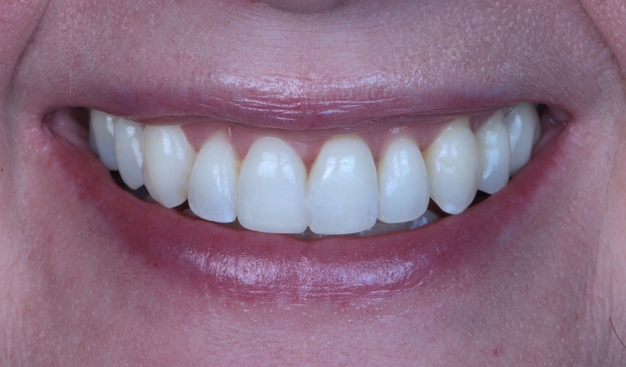 After -Dr Nina Shaffie