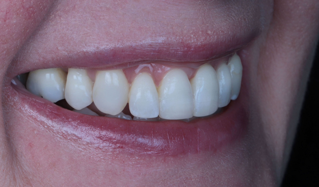 After -Dr Nina Shaffie