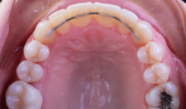 After -Dr Nina Shaffie