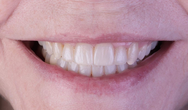 After -Dr Nina Shaffie