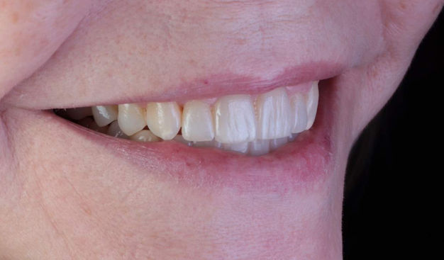 After -Dr Nina Shaffie