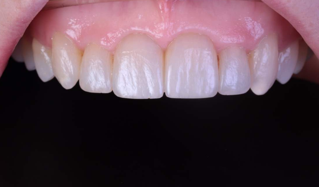 After -Dr Nina Shaffie