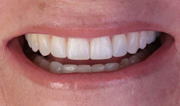 After -Dr Nina Shaffie