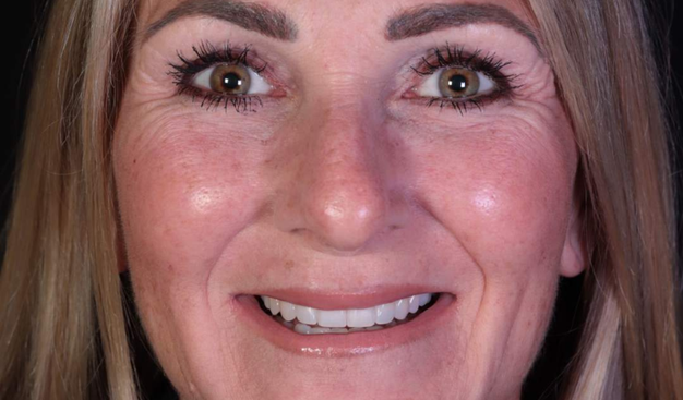 After -Dr Nina Shaffie