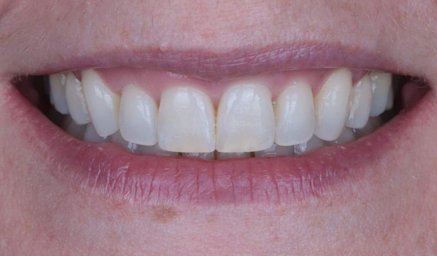 After -Dr Nina Shaffie