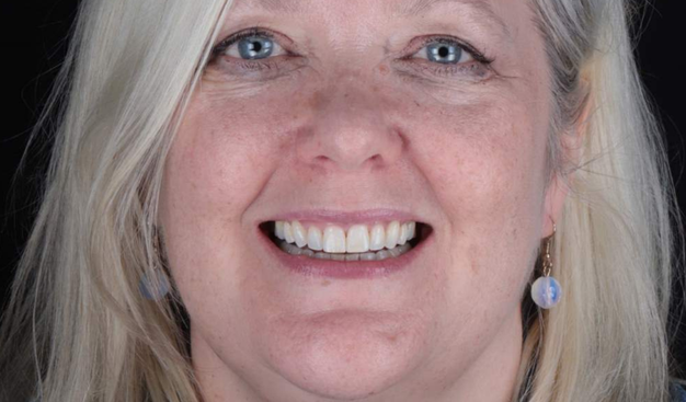 After -Dr Nina Shaffie