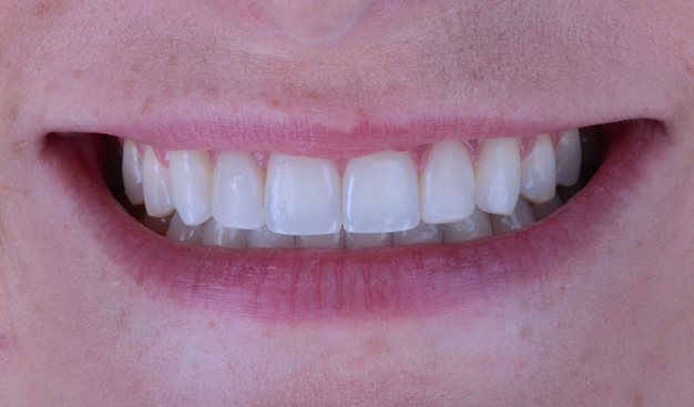 After -Dr Nina Shaffie