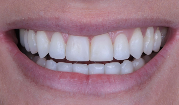 After -Dr Nina Shaffie