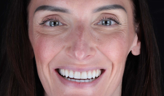 After -Dr Nina Shaffie