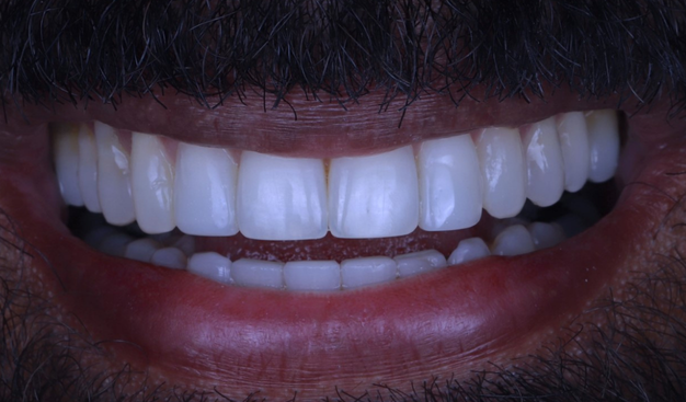 After -Dr Nina Shaffie