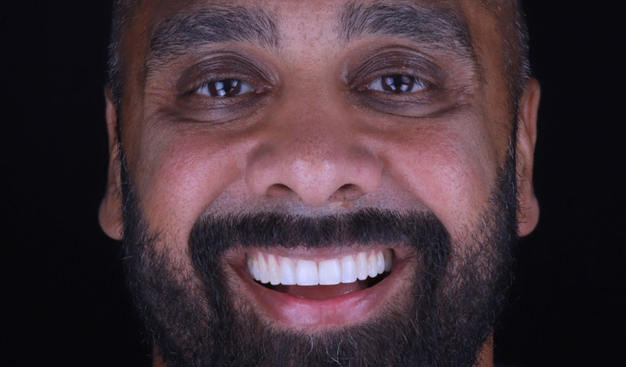 After -Dr Nina Shaffie