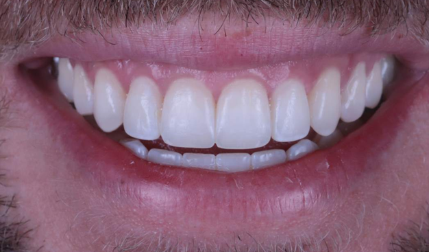 After -Dr Nina Shaffie