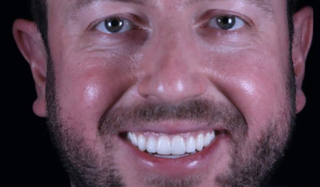 After -Dr Nina Shaffie