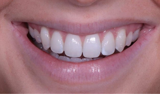 After -Dr Nina Shaffie