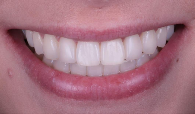 After -Dr Nina Shaffie