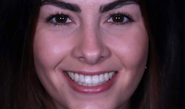 After -Dr Nina Shaffie