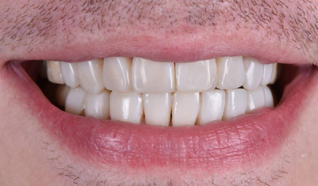 After -Dr Nina Shaffie