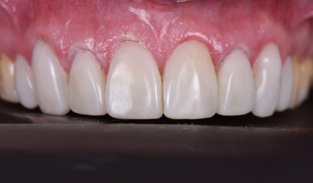 After -Dr Nina Shaffie