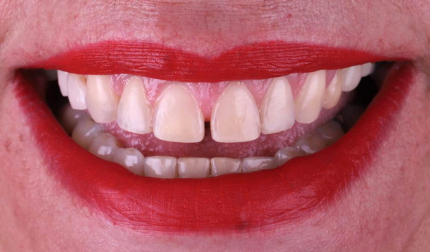 After -Dr Nina Shaffie