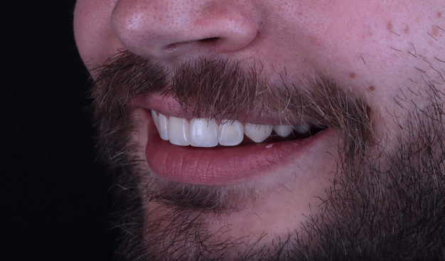 After -Dr Nina Shaffie