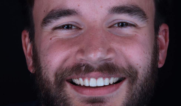 After -Dr Nina Shaffie