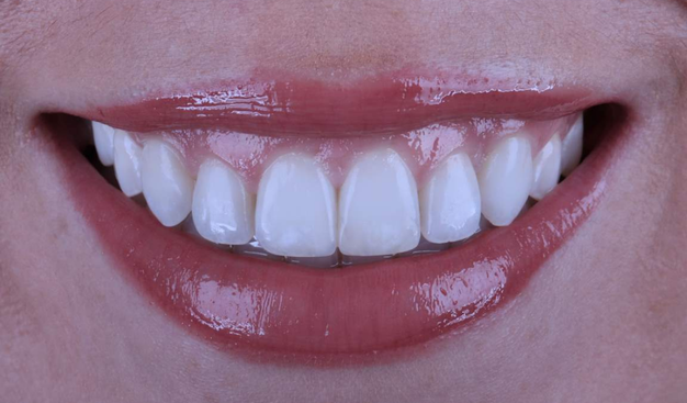 After -Dr Nina Shaffie