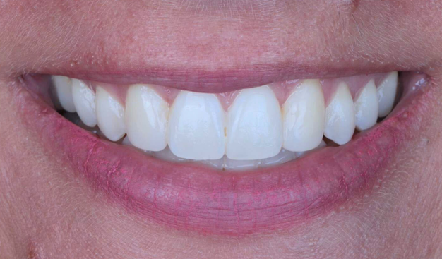 After -Dr Nina Shaffie