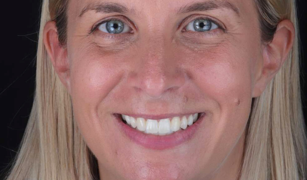 After -Dr Nina Shaffie