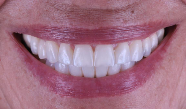 After -Dr Nina Shaffie