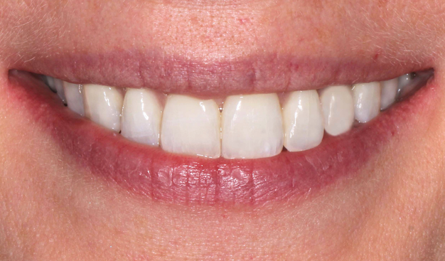 After -Dr Nina Shaffie