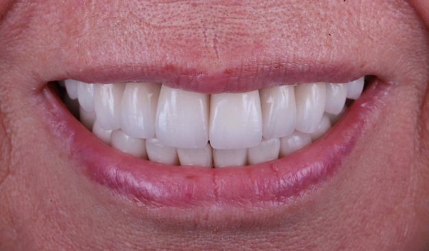 After -Dr Nina Shaffie