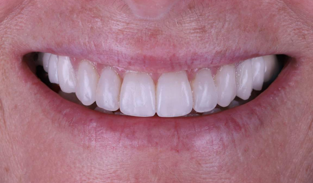 After -Dr Nina Shaffie