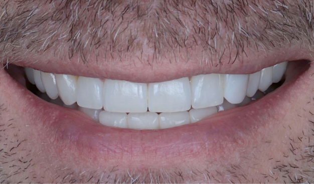 After -Dr Nina Shaffie