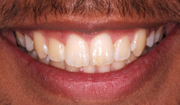 After -Dr Nina Shaffie