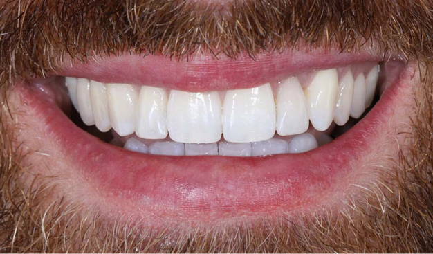 After -Dr Nina Shaffie