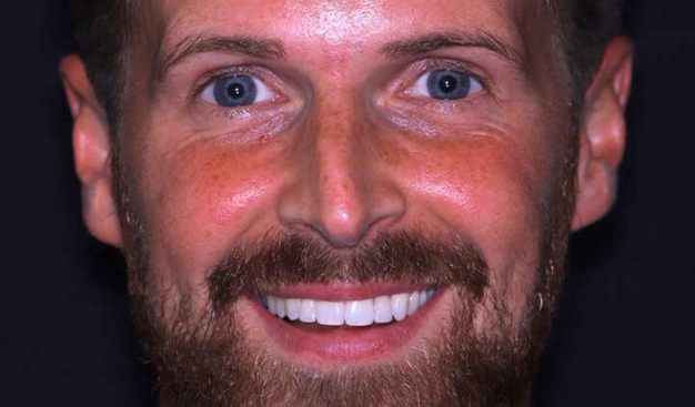 After -Dr Nina Shaffie