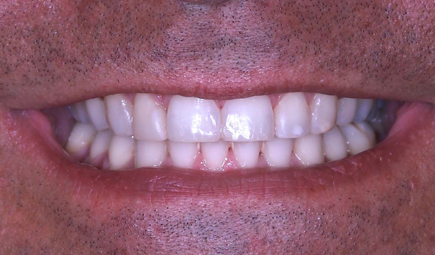 After -Dr Nina Shaffie