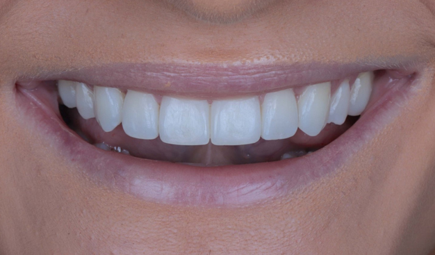 After -Dr Nina Shaffie