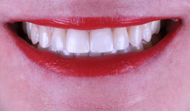 After -Dr Nina Shaffie