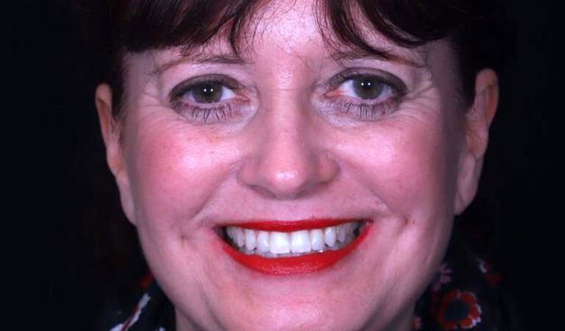 After -Dr Nina Shaffie