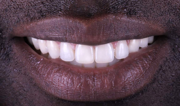 After -Dr Nina Shaffie