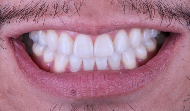 After -Dr Nina Shaffie