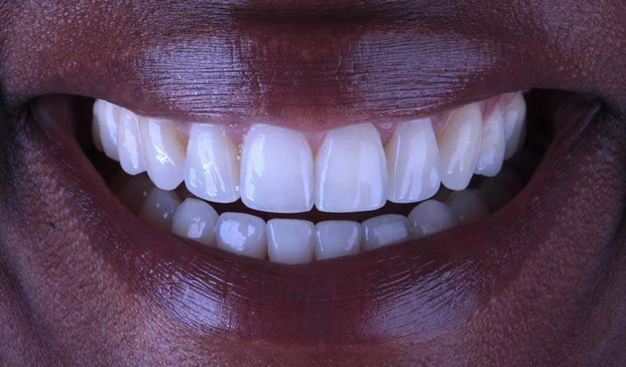 After -Dr Nina Shaffie