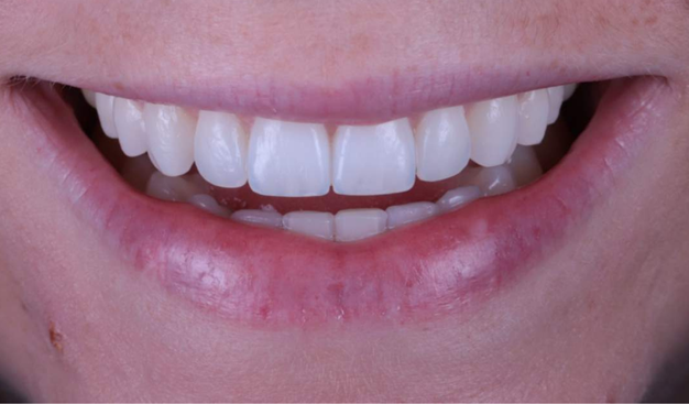 After -Dr Nina Shaffie