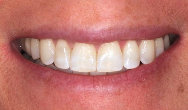 After -Dr Nina Shaffie