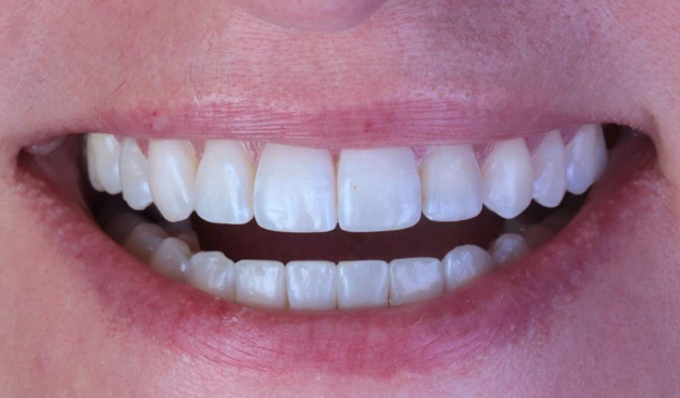 After -Dr Nina Shaffie