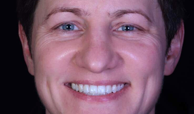 After -Dr Nina Shaffie