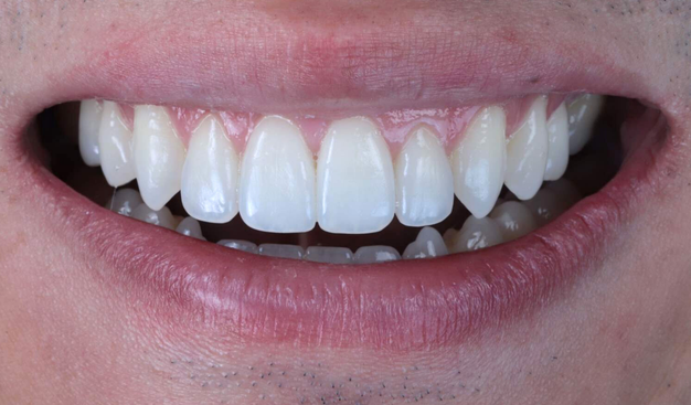 After -Dr Nina Shaffie