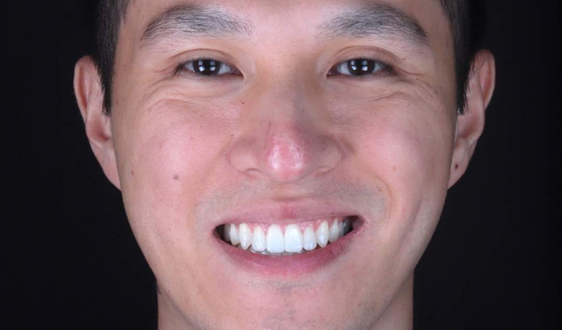 After -Dr Nina Shaffie