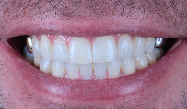 After -Dr Nina Shaffie